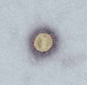 Foto Corona-Virus